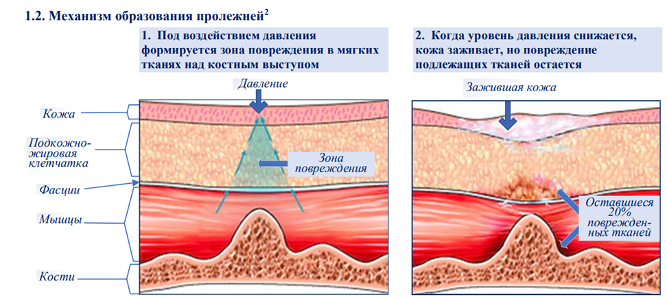 Иллюстрация из клинических рекомендаций