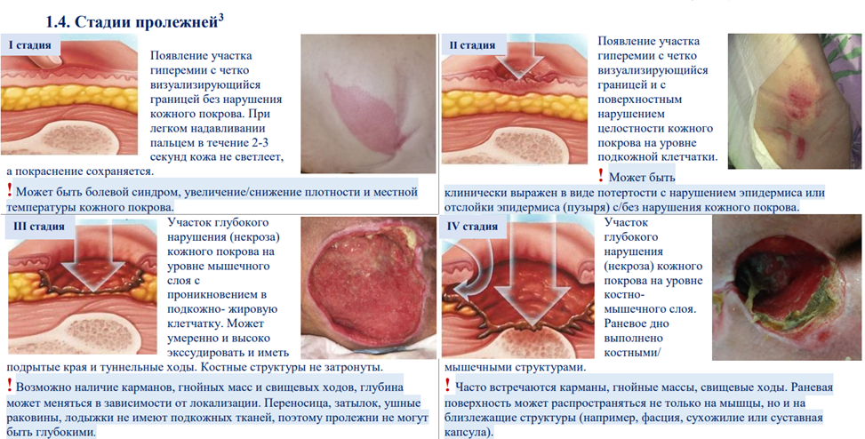 Иллюстрация из клинических рекомендаций