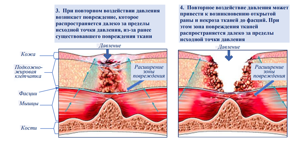 Иллюстрация из клинических рекомендаций